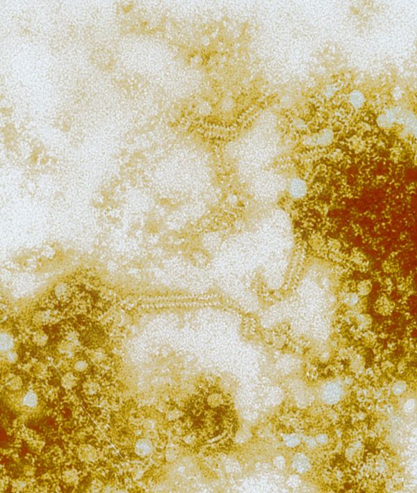 Virus des oreillons