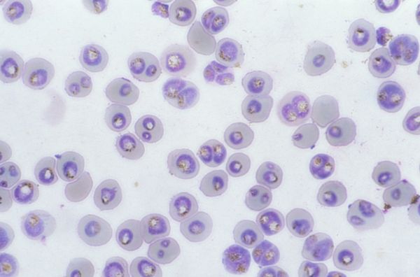 Plasmodium