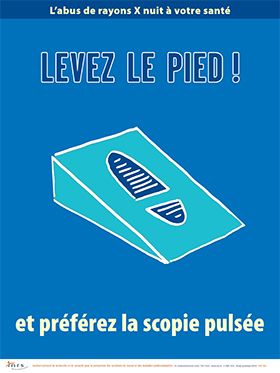 Levez le pied ! et préférez la scopie pulsée