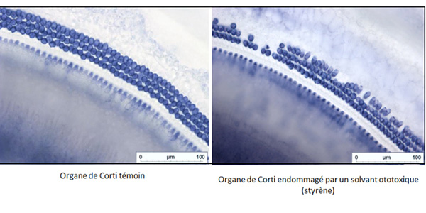 Cochlée saine et cochlée endommagée par un solvant