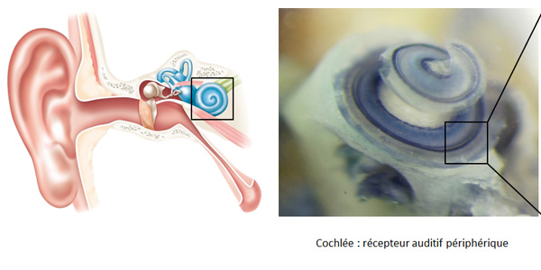 Cochlée saine et cochlée endommagée par un solvant